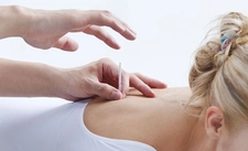 Akupunktur ile Sigara Bırakma